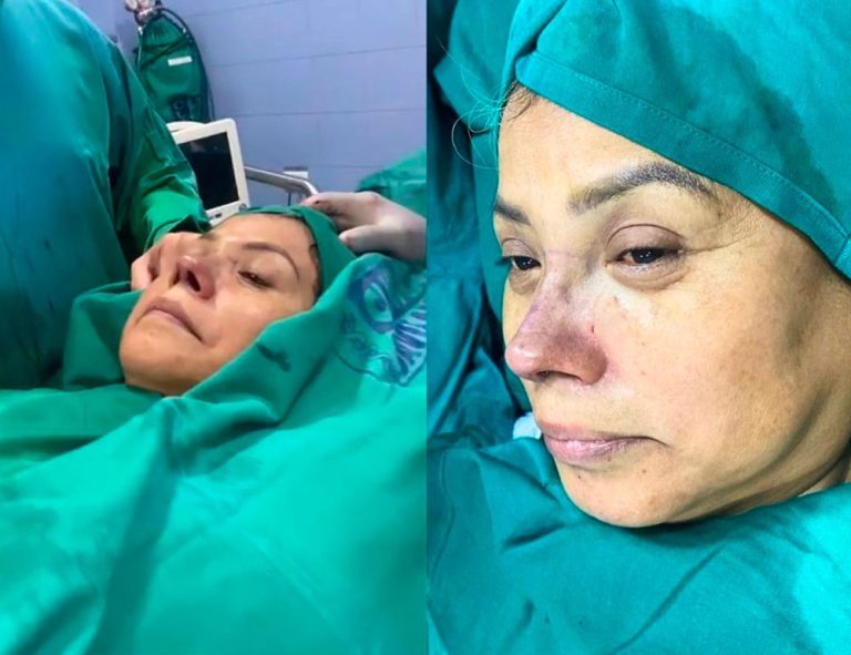 Post-operatorio inmediato