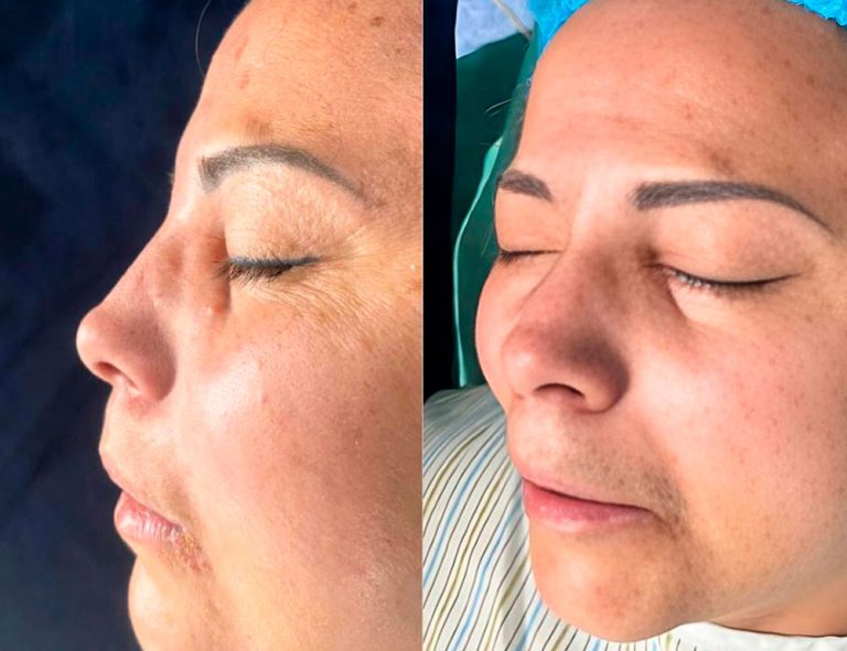 Paciente antes de la cirugía