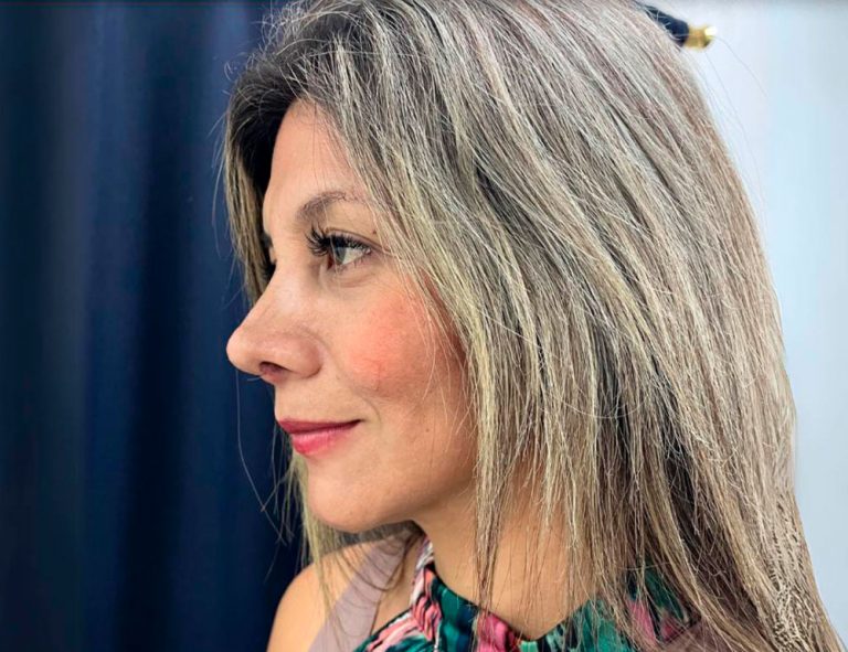 Post-operatorio (15 días)