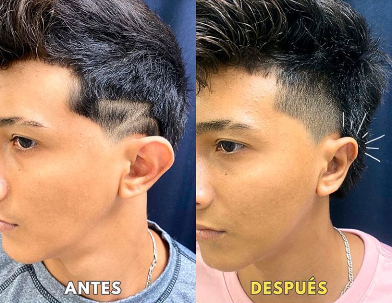 Post-operatorio (40 días)