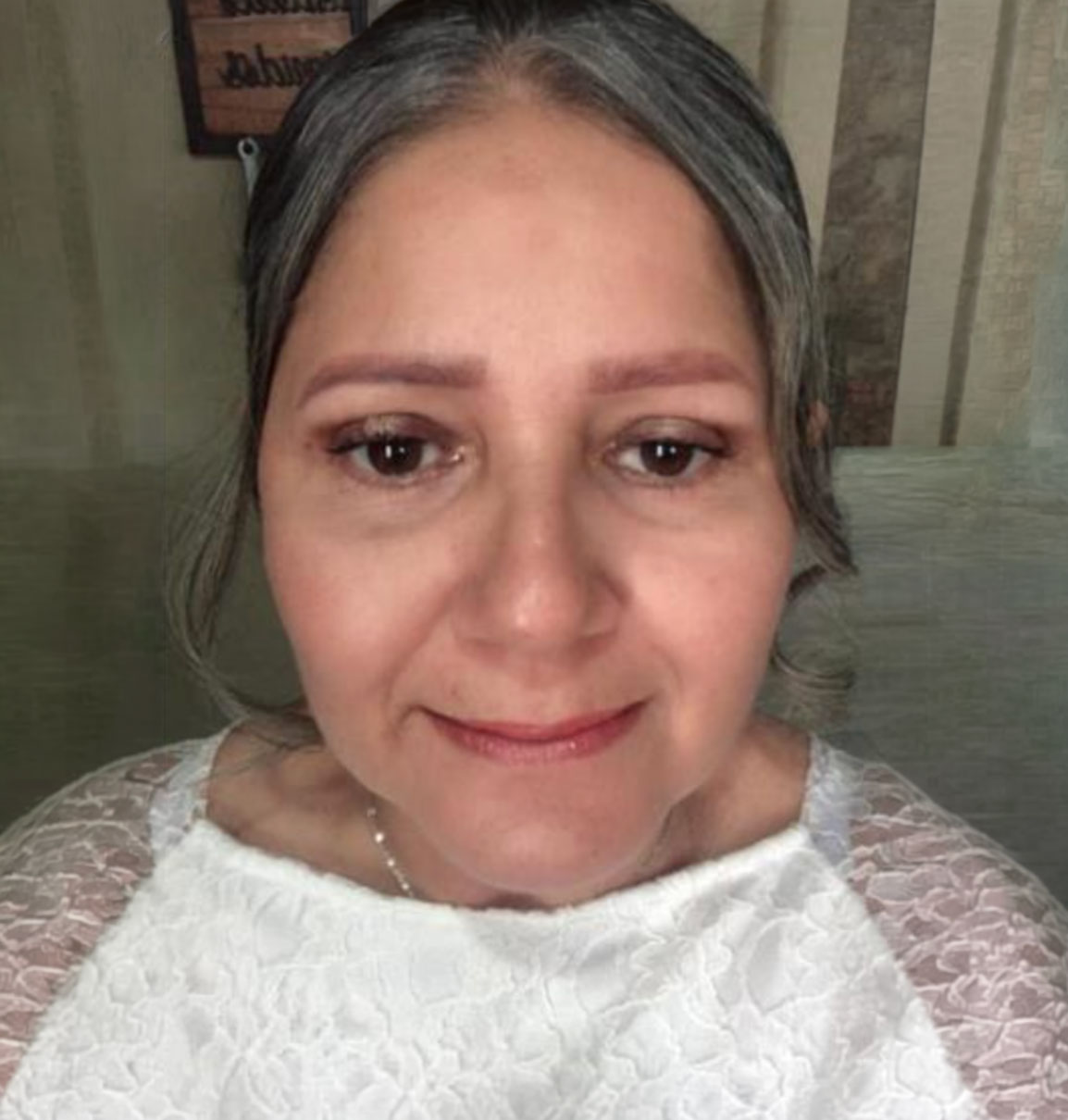 Paciente de Blefaroplastia